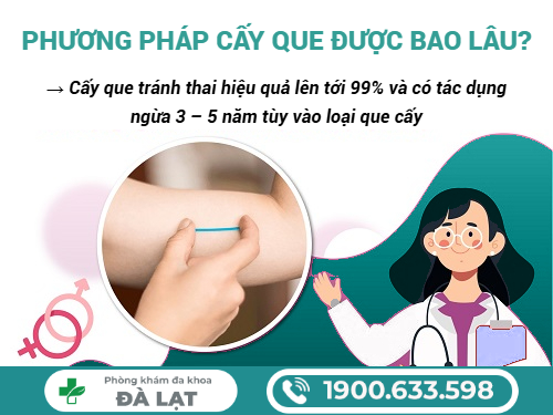 Hình ảnh minh họa